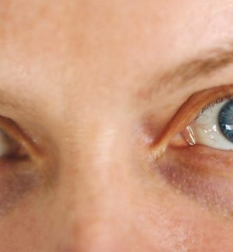 Cataratas en los ojos: qué son y cómo se producen