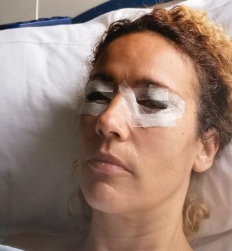 cirugia-de-los-parpados