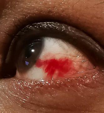 cancer-de-ojos Ojo humano / fotografía de ojos / cuidar los ojos