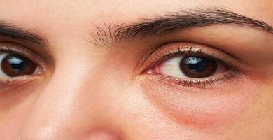 conducto-lagrimal Ojo humano / fotografía de ojos / cuidar los ojos