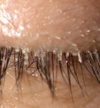 el-demodex Ojo humano / fotografía de ojos / cuidar los ojos