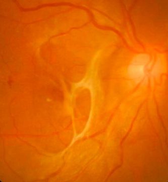 la-macula-del-ojo Ojo humano / fotografía de ojos / cuidar los ojos