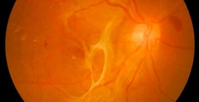 la-macula-del-ojo Ojo humano / fotografía de ojos / cuidar los ojos