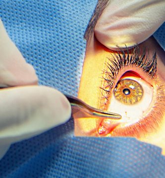 lentes-intraoculares Ojo humano / fotografía de ojos / cuidar los ojos