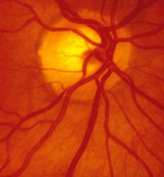 por-que-se-desprende-la-retina Ojo humano / fotografía de ojos / cuidar los ojos