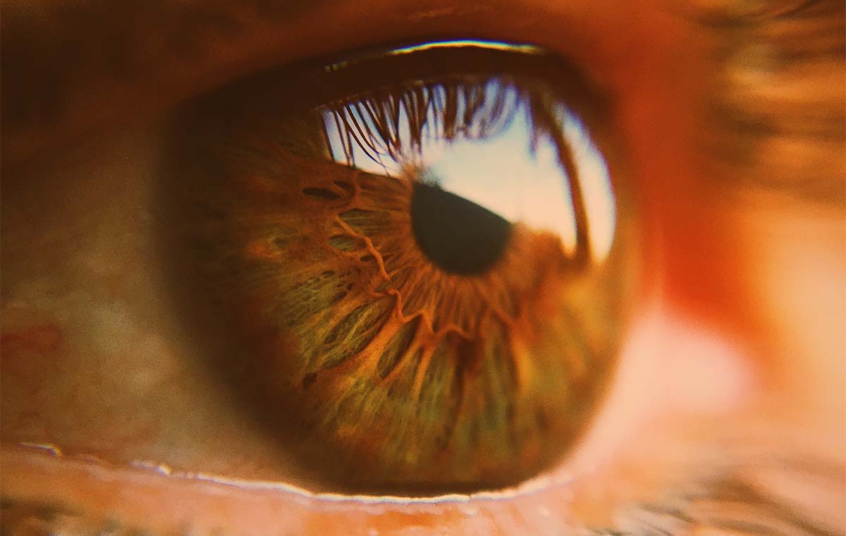 trasplante de córnea Ojo humano / fotografía de ojos / cuidar los ojos