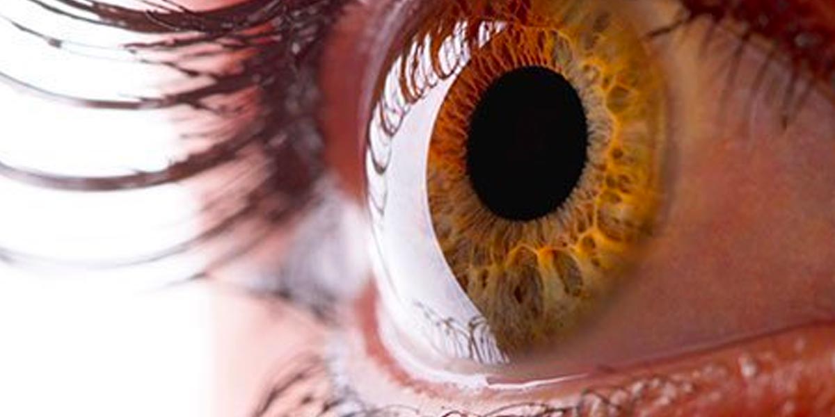 trastornos-en-la-cornea Ojo humano / fotografía de ojos / cuidar los ojos