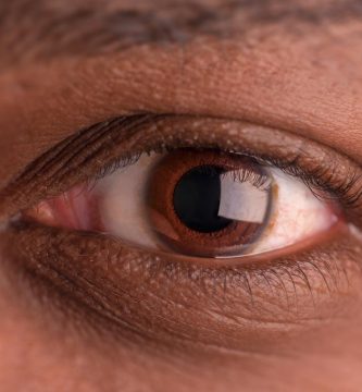 vitrectomía Ojo humano / fotografía de ojos / cuidar los ojos