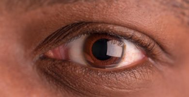 vitrectomía Ojo humano / fotografía de ojos / cuidar los ojos