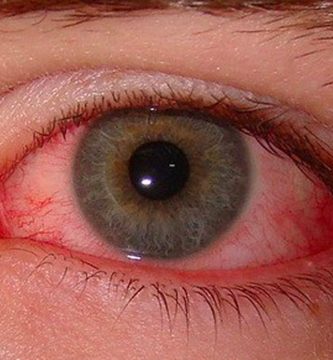 prevenir-la-conjuntivitis -ojos rojos / Ojo humano / fotografía de ojos / cuidar los ojos