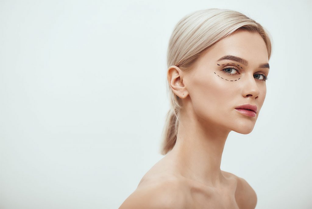 la-blefaroplastia
