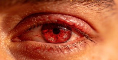 primer-plano-de-un-ojo-sindrome-de-ojos-secos
